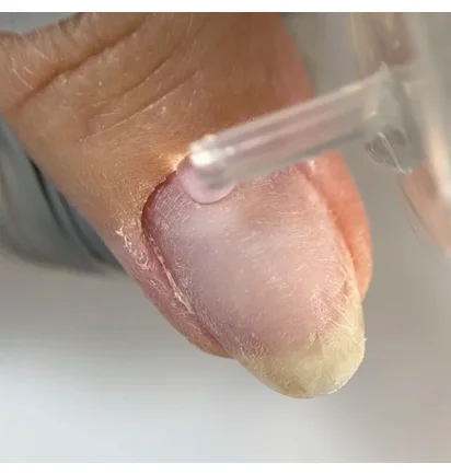 Ремувер для кутикули Nails Of The Day Cuticle 10%, 60 мл