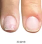 Regenerujący olejek na onycholizę Nails Of The Day, 8 ml